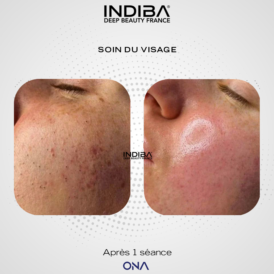 Nettoyage-visage-ONA-2